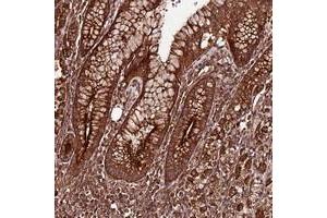 Immunohistochemical staining of human stomach with FAM186A polyclonal antibody  shows strong cytoplasmic positivity in glandular cells.
