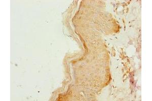 Immunohistochemistry of paraffin-embedded human skin tissue using ABIN7148168 at dilution of 1:100 (CCDC89 antibody  (AA 1-200))