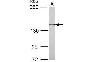 WB Image Sample (30 ug of whole cell lysate) A: MCF-7 5% SDS PAGE antibody diluted at 1:1000 (MAP4K6 antibody  (C-Term))