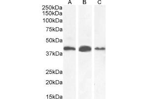 (ABIN2613379) (0. (AMACR antibody  (AA 312-326))