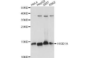 Western blot analysis of extracts of various cell lines, using HIGD1A antibody. (HIGD1A antibody)