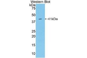 Western blot analysis of the recombinant protein. (Osteocalcin antibody  (AA 11-98))