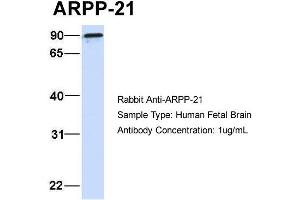 Host:  Rabbit  Target Name:  ARPP-21  Sample Type:  Human Fetal Brain  Antibody Dilution:  1. (ARPP21 antibody  (N-Term))
