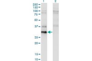 Western Blot analysis of BCL7B expression in transfected 293T cell line by BCL7B monoclonal antibody (M02), clone 4G1.