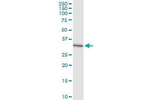 Immunoprecipitation of CCS transfected lysate using anti-CCS MaxPab rabbit polyclonal antibody and Protein A Magnetic Bead , and immunoblotted with CCS purified MaxPab mouse polyclonal antibody (B01P) . (Superoxide dismutase copper chaperone antibody  (AA 1-274))