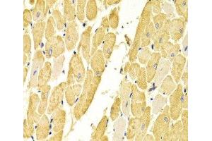 Immunohistochemistry of paraffin-embedded Rat heart using CA3 Polyclonal Antibody at dilution of 1:100 (40x lens). (CA3 antibody)