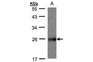 WB Image Sample(30 ug whole cell lysate) A: Raji, 12% SDS PAGE antibody diluted at 1:500 (UQCRFS1 antibody)