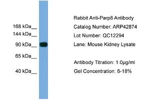 WB Suggested Anti-Parp8 Antibody Titration:  0. (PARP8 antibody  (N-Term))