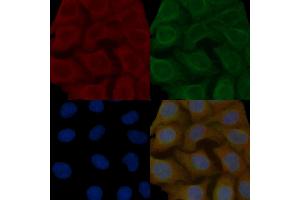 Synapsin I Mouse Monoclonal Antibody staining Hela cells by IF/ICC.