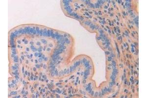 Detection of CD34 in Mouse Uterus Tissue using Polyclonal Antibody to Cluster Of Differentiation 34 (CD34) (CD34 antibody  (AA 36-287))