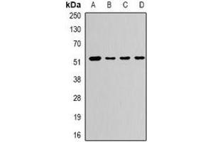 Western blot analysis of CaMK1 gamma expression in PC12 (A), A673 (B), mouse liver (C), rat brain (D) whole cell lysates. (CAMK1G antibody)
