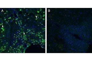Expression of Calcitonin Receptor-Like Receptor in mouse brain stem - Immunohistochemical staining of perfusion-fixed frozen mouse brain sections with Anti-CRLR/CALCRL (extracellular) (extracellular) Antibody (ABIN7042979, ABIN7044198 and ABIN7044199), (1:200), followed by goat anti-rabbit-AlexaFluor-488. (CALCRL antibody  (C-Term, Intracellular))