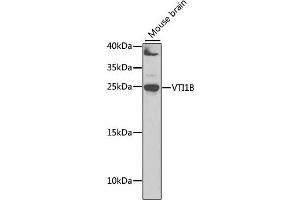 Western blot analysis of extracts of mouse brain, using VTI1B antibody (ABIN6132781, ABIN6150162, ABIN6150163 and ABIN6222854) at 1:1000 dilution. (VTI1B antibody  (AA 1-210))