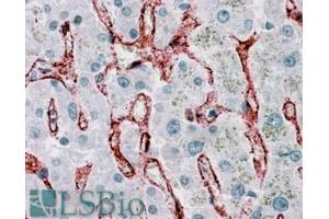 ABIN185377 (3. (FCGR2B antibody  (C-Term))