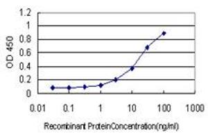 Detection limit for recombinant GST tagged ATR is approximately 0. (ATR antibody  (AA 2545-2644))
