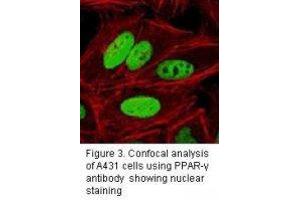 Image no. 3 for anti-Peroxisome Proliferator-Activated Receptor gamma (PPARG) antibody (ABIN232120) (PPARG antibody)