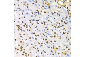 Immunohistochemistry of paraffin-embedded rat kidney using SFN Antibody. (14-3-3 sigma/SFN antibody)