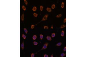 Immunofluorescence analysis of L929 cells using CCT6B antibody (ABIN7270709) at dilution of 1:100. (CCT6B antibody  (AA 120-340))