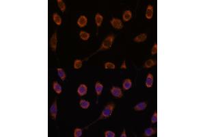 Immunofluorescence analysis of L929 cells using CCT6B antibody (ABIN7270709) at dilution of 1:100. (CCT6B antibody  (AA 120-340))