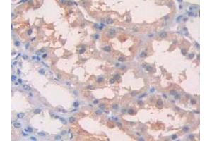 Figure. (IL1R1 antibody  (AA 120-208))