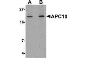 Western blot analysis of APC10 in mouse heart tissue lysate with APC10 antibody at (A) 1 and (B) 2 μg/ml. (ANAPC10 antibody  (Center))