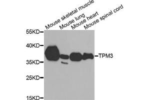 Western blot analysis of extracts of various cell lines, using TPM3 antibody (ABIN6291029) at 1:1000 dilution. (TPM3 antibody)