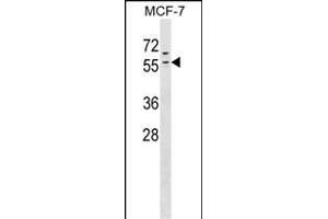 ZNF383 antibody  (N-Term)