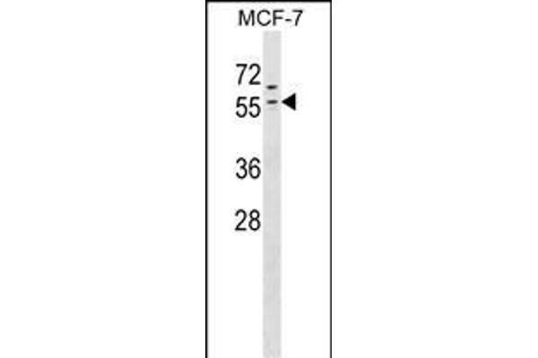 ZNF383 Antikörper  (N-Term)