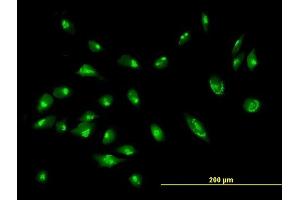 Immunofluorescence of purified MaxPab antibody to GORASP2 on HeLa cell. (GORASP2 antibody  (AA 1-452))