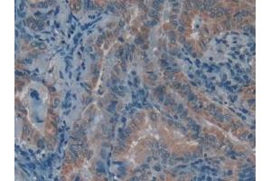 Immunohistochemistry (IHC) image for anti-Lysophosphatidylcholine Acyltransferase 3 (LPCAT3) (AA 122-233) antibody (ABIN7436327)