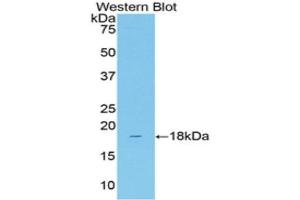 Western Blotting (WB) image for anti-Solute Carrier Family 12 (Sodium/Chloride Transporters), Member 3 (SLC12A3) (AA 3-146) antibody (ABIN1859968) (SLC12A3 antibody  (AA 3-146))