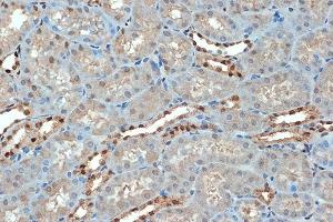 Immunohistochemistry of paraffin-embedded mouse kidney using SUMO4 Rabbit mAb (ABIN7270372) at dilution of 1:100 (40x lens). (SUMO4 antibody)