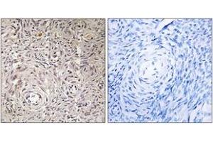 Immunohistochemistry analysis of paraffin-embedded human ovary tissue, using GCNT7 Antibody. (GCNT7 antibody  (AA 311-360))