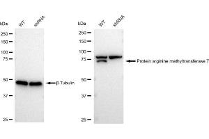 Western blotting analysis using Protein arginine methyltransferase 7 antibody (ABIN7799973). (Recombinant PRMT7 antibody)