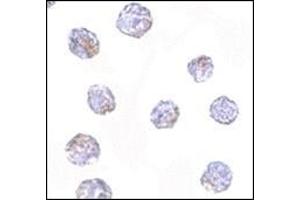 Immunocytochemistry of MARCH8 in HeLa cells with this product at 2. (MARCH8 antibody  (C-Term))