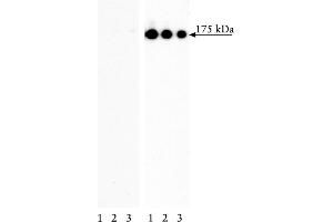 Western Blotting (WB) image for anti-Epidermal Growth Factor Receptor (EGFR) (pTyr845) antibody (ABIN967602) (EGFR antibody  (pTyr845))