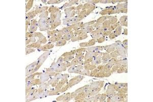 Immunohistochemistry of paraffin-embedded rat heart using FIS1 Antibody. (Fission 1 antibody  (AA 1-122))