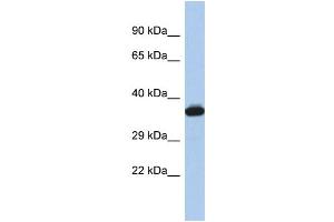 Western Blotting (WB) image for anti-GTPase, IMAP Family Member 2 (GIMAP2) (Middle Region) antibody (ABIN2786558) (GIMAP2 antibody  (Middle Region))