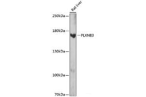 Western blot analysis of extracts of Rat liver using PLXNB3 Polyclonal Antibody at dilution of 1:1000.