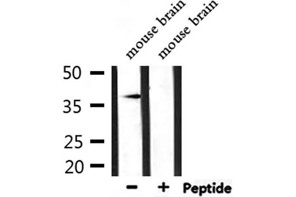 AKR1C3 antibody