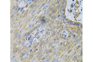 Immunohistochemistry of paraffin-embedded Human esophagus using PDGFB Polyclonal Antibody at dilution of 1:100 (40x lens). (PDGFB antibody)