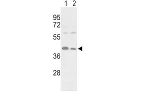 Western Blotting (WB) image for anti-Phosphoglycerate Kinase 1 (PGK1) antibody (ABIN3002985) (PGK1 antibody)