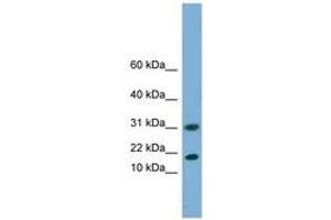Image no. 1 for anti-Eukaryotic Translation Initiation Factor 5A2 (EIF5A2) (N-Term) antibody (ABIN6744192)