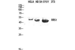 Western Blot (WB) analysis of HeLa, KB, SH-SY5Y lysis using RRS1 antibody. (RRS1 antibody  (Internal Region))