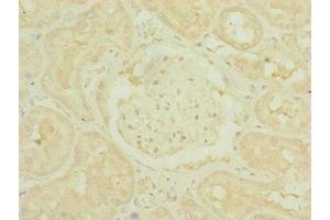 Immunohistochemistry of paraffin-embedded human kidney tissue using ABIN7159887 at dilution of 1:100 (TIMM1B (AA 1-103) antibody)