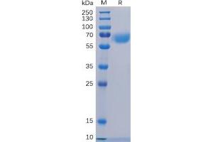 Human CD48 Protein, hFc Tag on SDS-PAGE under reducing condition.