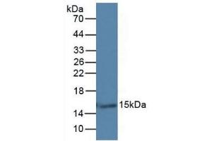 Detection of GAL7 in Rat Skin Tissue using Monoclonal Antibody to Galectin 7 (GAL7) (LGALS7 antibody  (AA 1-136))