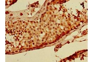 Immunohistochemistry of paraffin-embedded human testis tissue using ABIN7169019 at dilution of 1:100 (BRSK1 antibody  (AA 426-591))