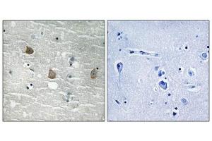 Immunohistochemical analysis of paraffin-embedded human brain tissue using TOB1 (Phospho-Ser164) antibody (left)or the same antibody preincubated with blocking peptide (right). (Protein Tob1 (TOB1) (pSer164) antibody)