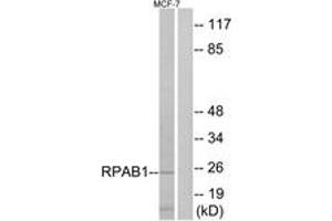 Western blot analysis of extracts from MCF-7 cells, using RPAB1 Antibody. (POLR2E antibody  (AA 21-70))
